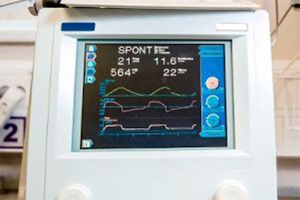 生体情報モニター