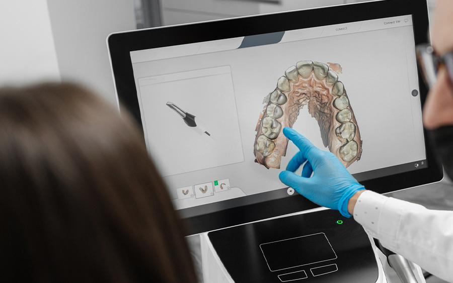 お口の型取りへのこだわり