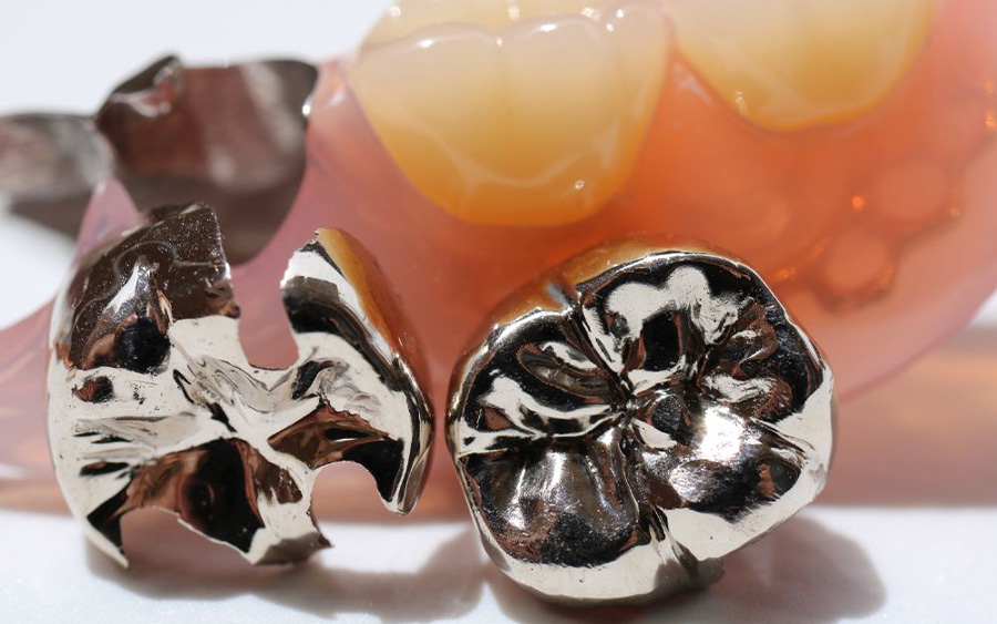 保険診療とは？