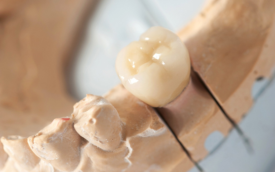 自由診療とは？