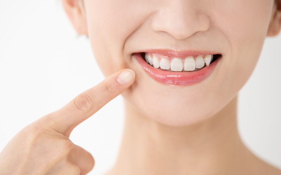 口元のコンプレックスを解消