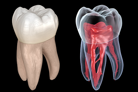 拡大視野で、見落としのない丁寧な根管治療を