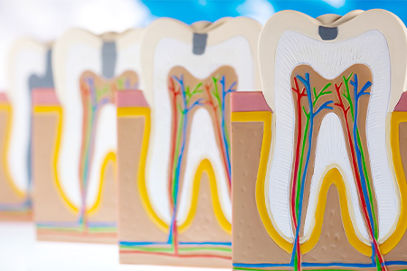 根管治療とは？