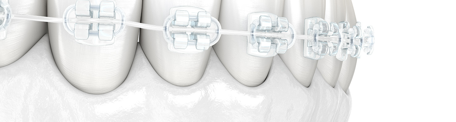 矯正歯科・小児矯正歯科