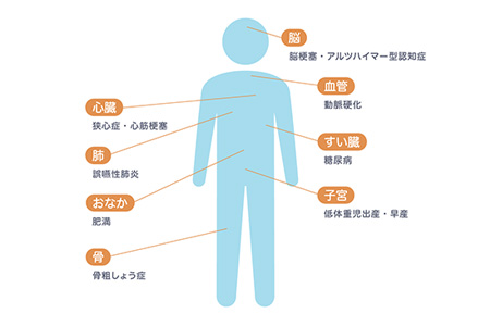 全身疾患との関係