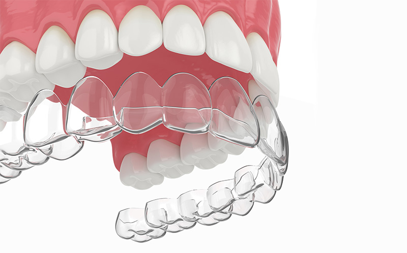 矯正歯科・小児矯正歯科